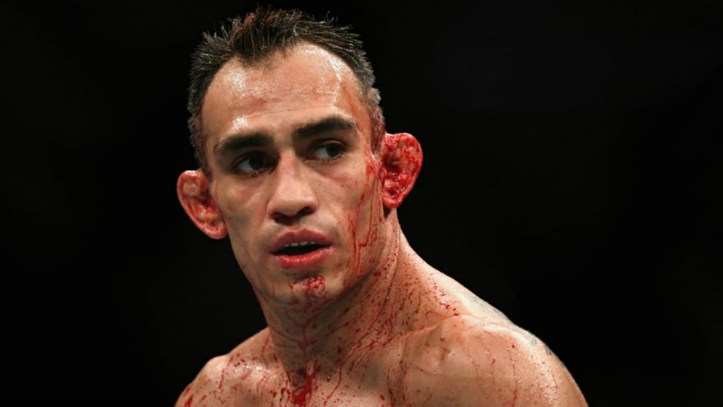 Tony Ferguson