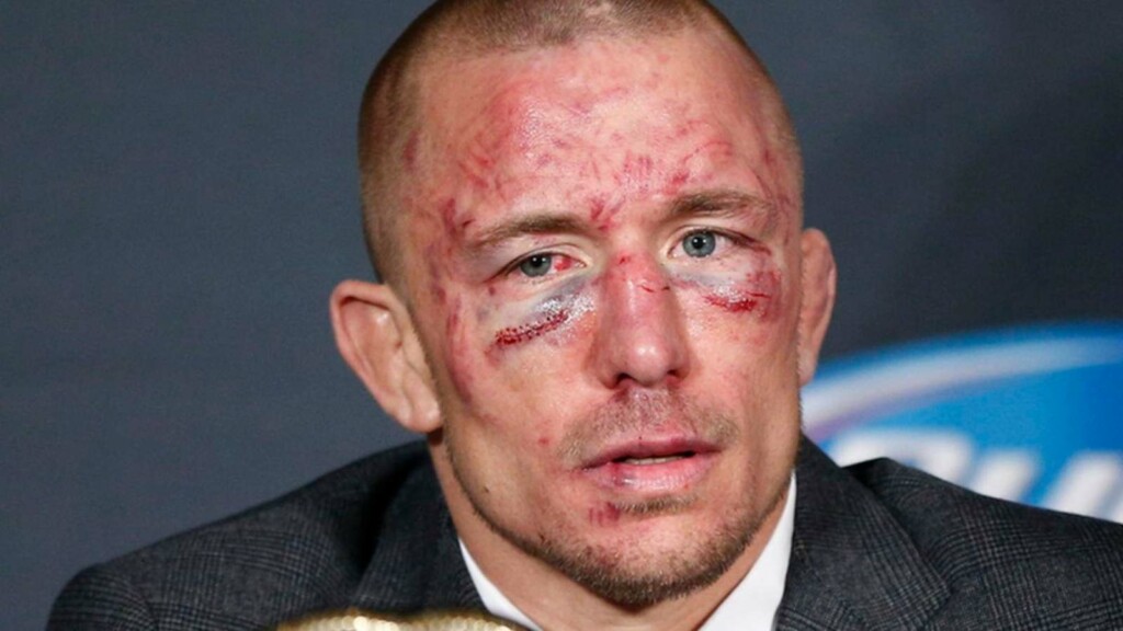 Georges St Pierre