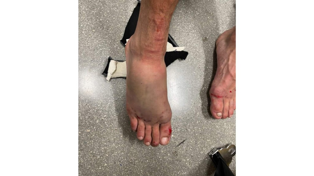 Yair Rodriguez's foot