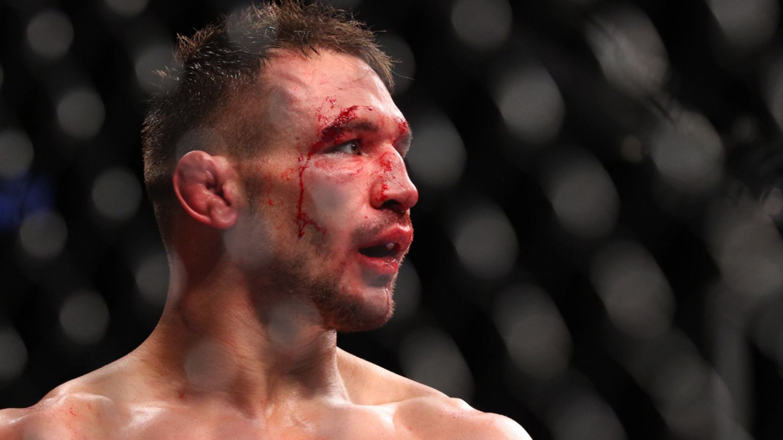 WATCH! Michael Chandler gets 22 stitches to recovery from the fight of the year candidate that took place at UFC 268