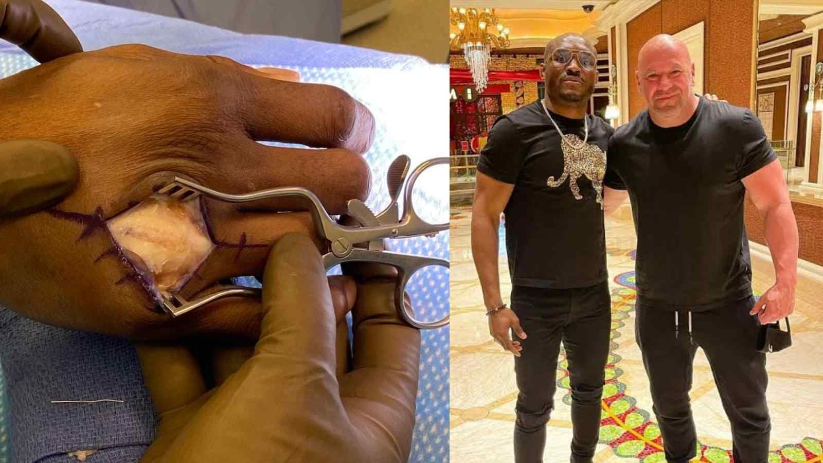 UFC President Dana White shares gruesome images of welterweight champion Kamaru Usman’s ligament surgery