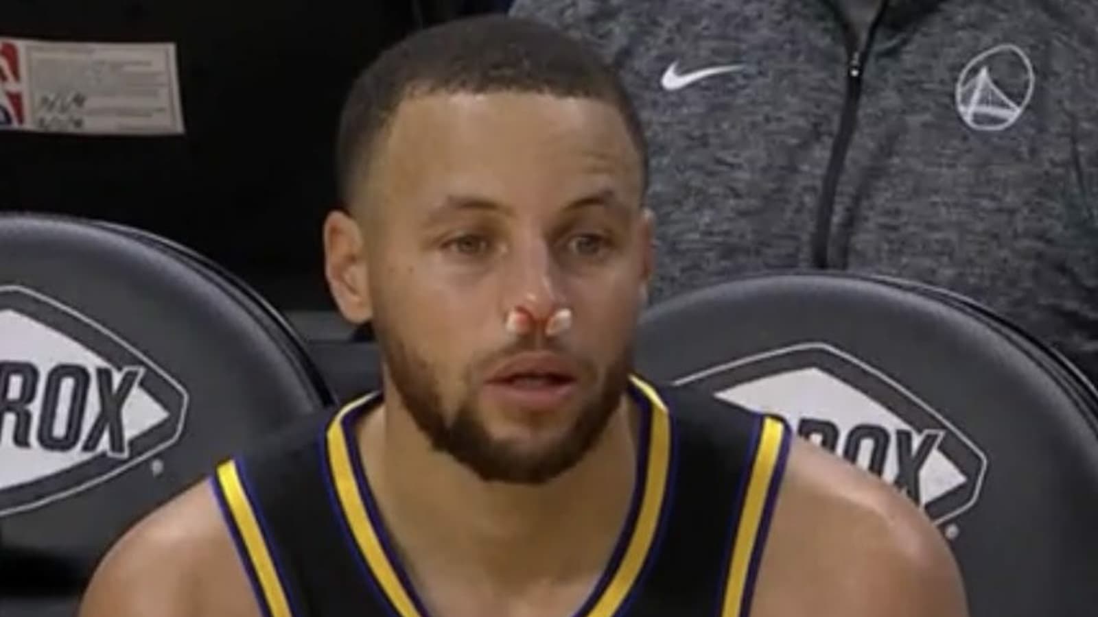 “Wounded Lion Still Deadly” Twitter reacts to Stephen Curry playing through a Nasty Nose-Shattering injury