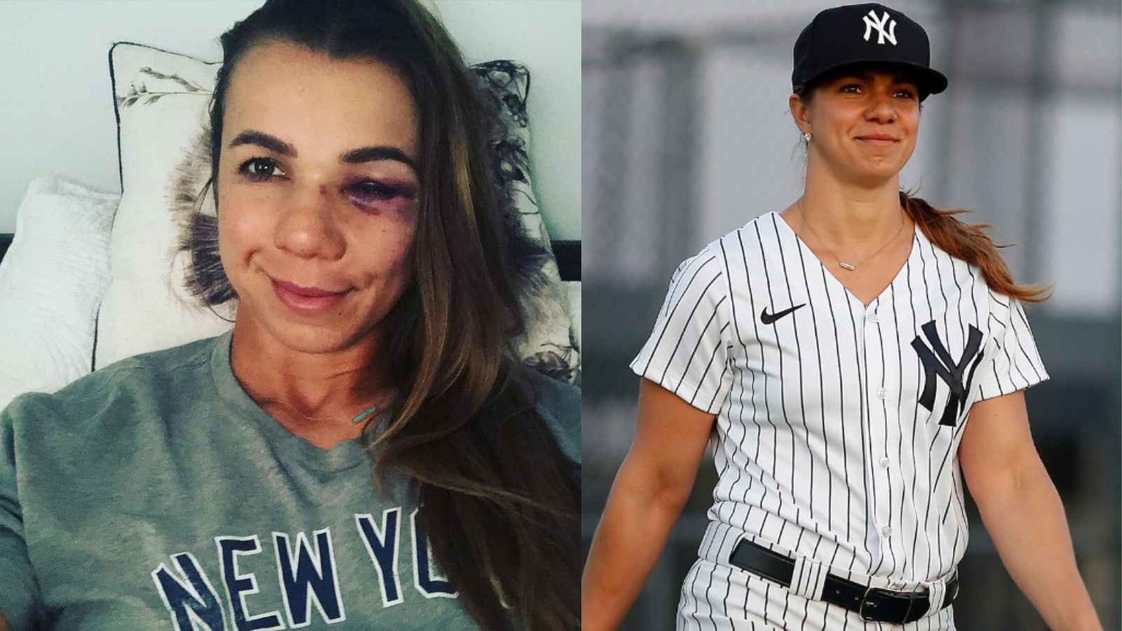 Baseball’s first female manager Rachel Balkovec suffers nasty injury during hitting drill with Yankees