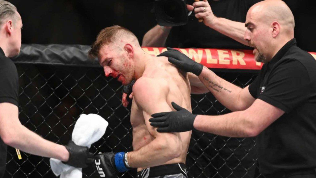 Dan Hooker after losing to Arnold Allen at UFC London