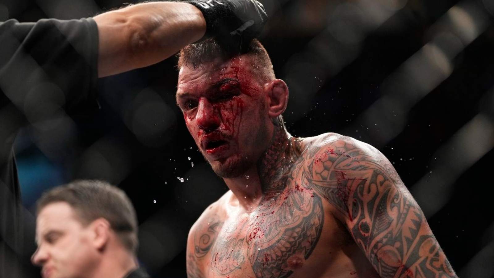 “Fighter may never be the same again”- Michael Bisping ridicules Renato Moicano’s corner for letting him fight at UFC 272