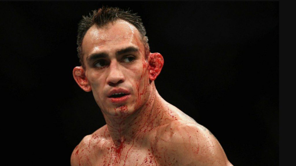 Tony Ferguson 