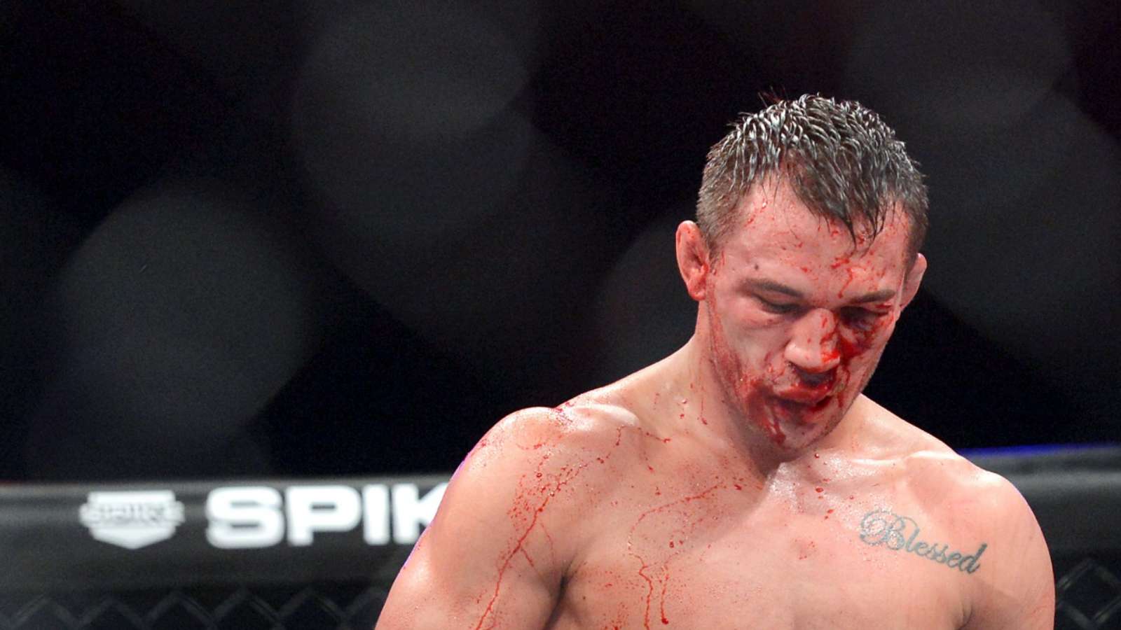 “The day after”- Michael Chandler shows off a gruesome injury as he recovers post-UFC 274