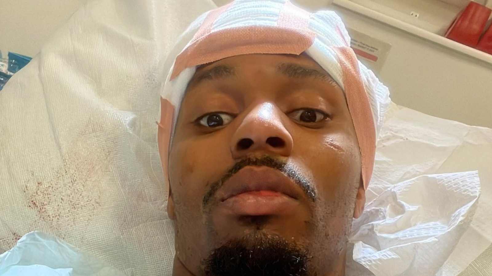 “Another near-death experience”- Lerone Murphy survives a terrifying biking accident