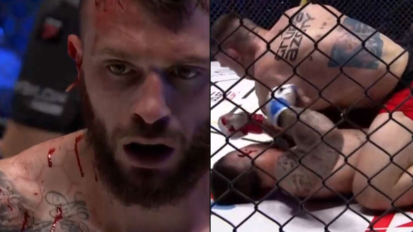 WATCH: Italian fighter Alessandro Botti gets his ear sliced during fight at Babylon MMA 29