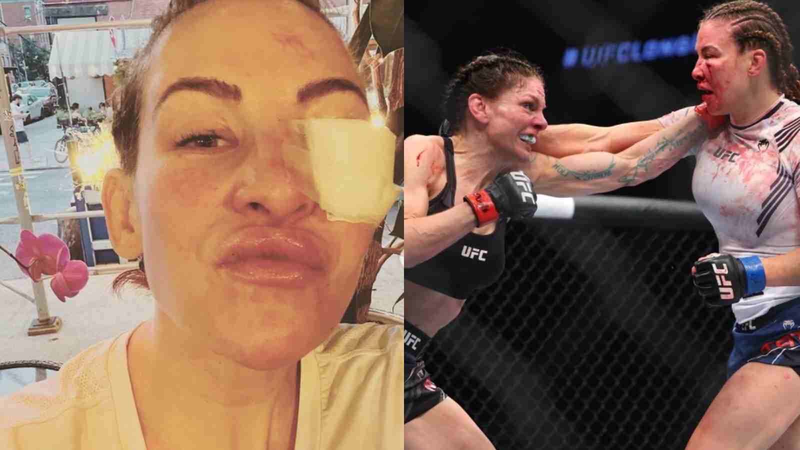 “Some women pay for lips like this” – Miesha Tate gives classy reaction after bloody fight against Lauren Murphy