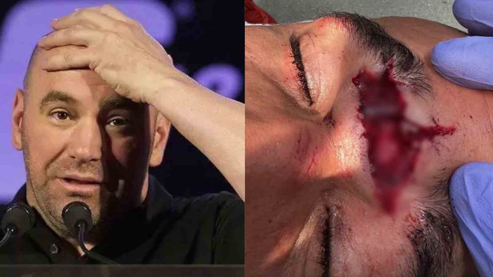 WATCH: Dana White shares HORRIFYING picture of blood-shed UFC Vegas 60 fighter