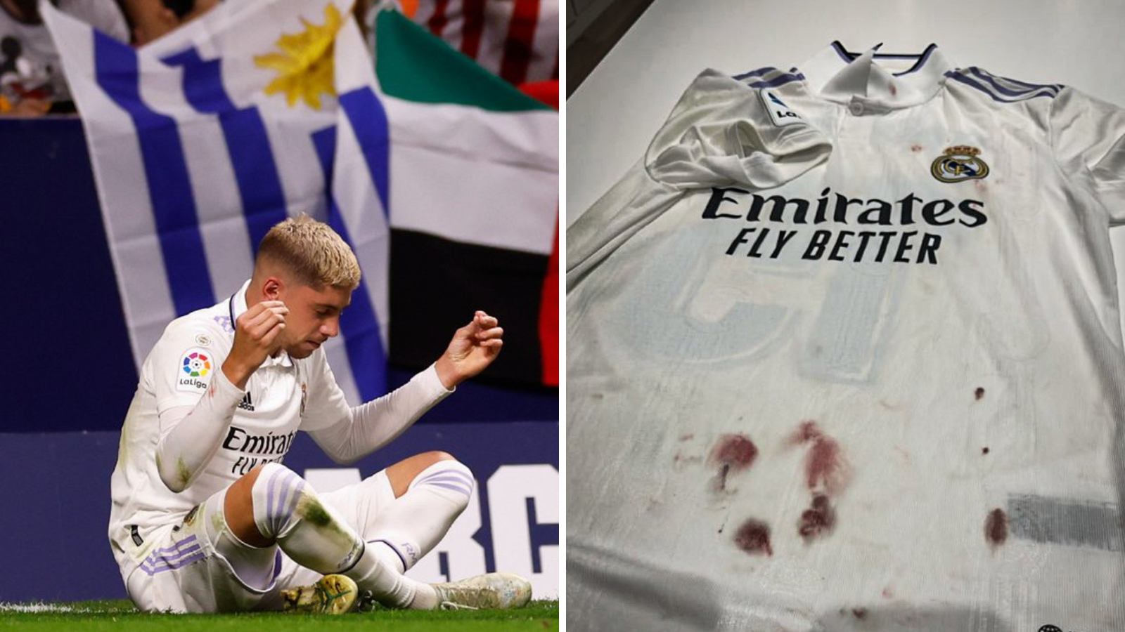 “Have you just finished a war?”  Here’s how Real Madrid star Federico Valverde’s shirt looks after Madrid derby