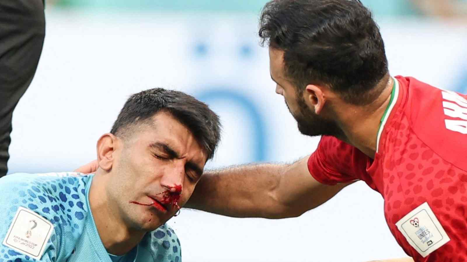 “Do concussion protocols even exist?” – Twitter reacts as Iran’s goalkeeper tries to continue playing with bloody nose after eventually leaving against England