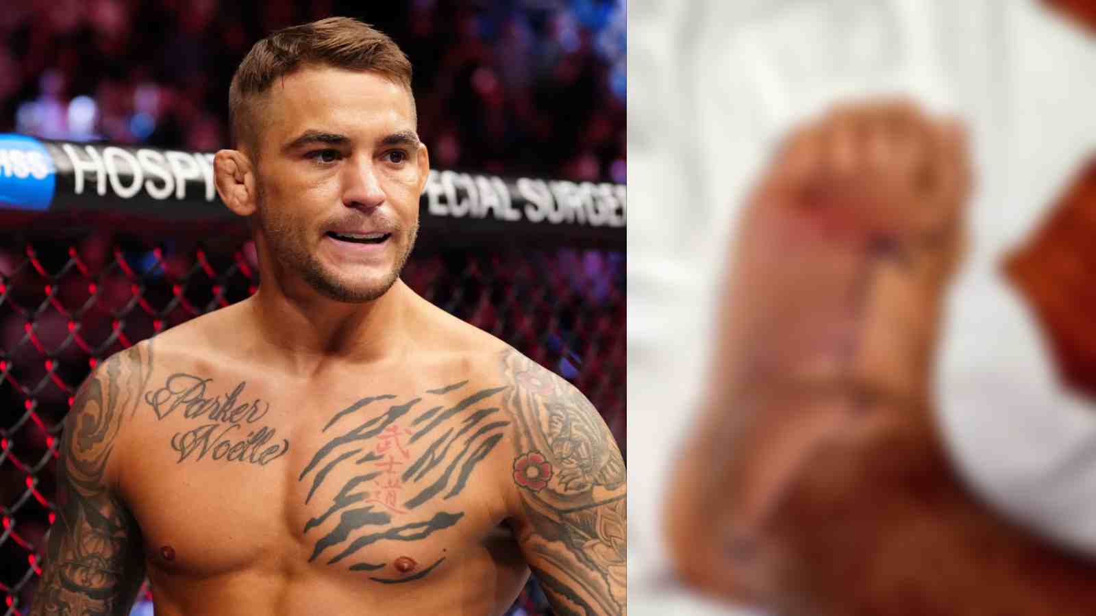 “Wut da helllll,” Dustin Poirier shares a HORRIFYING photo of his staph infection and provides an update on the situation