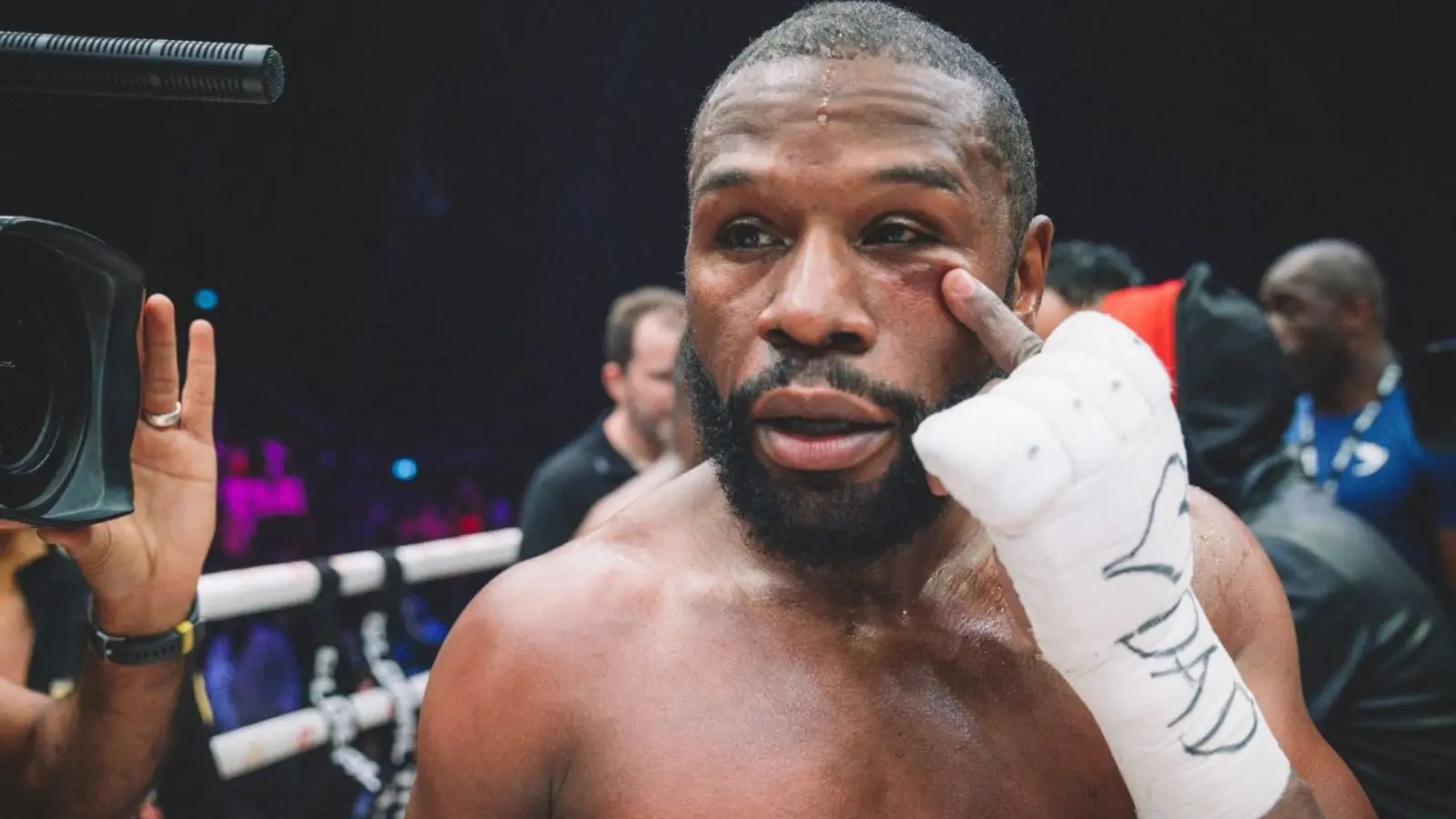 “I had to close the gap,” Floyd Mayweather gives a HILARIOUS excuse for getting a black eye against Deji