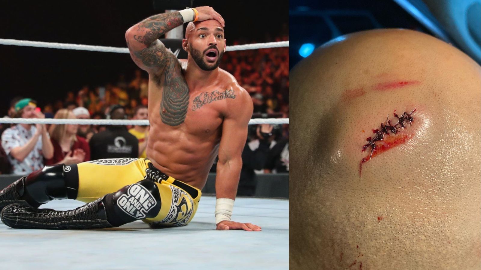 “Least it’s not coal” Ricochet Displays Lump and Stitches After Nasty Gash On WWE SmackDown